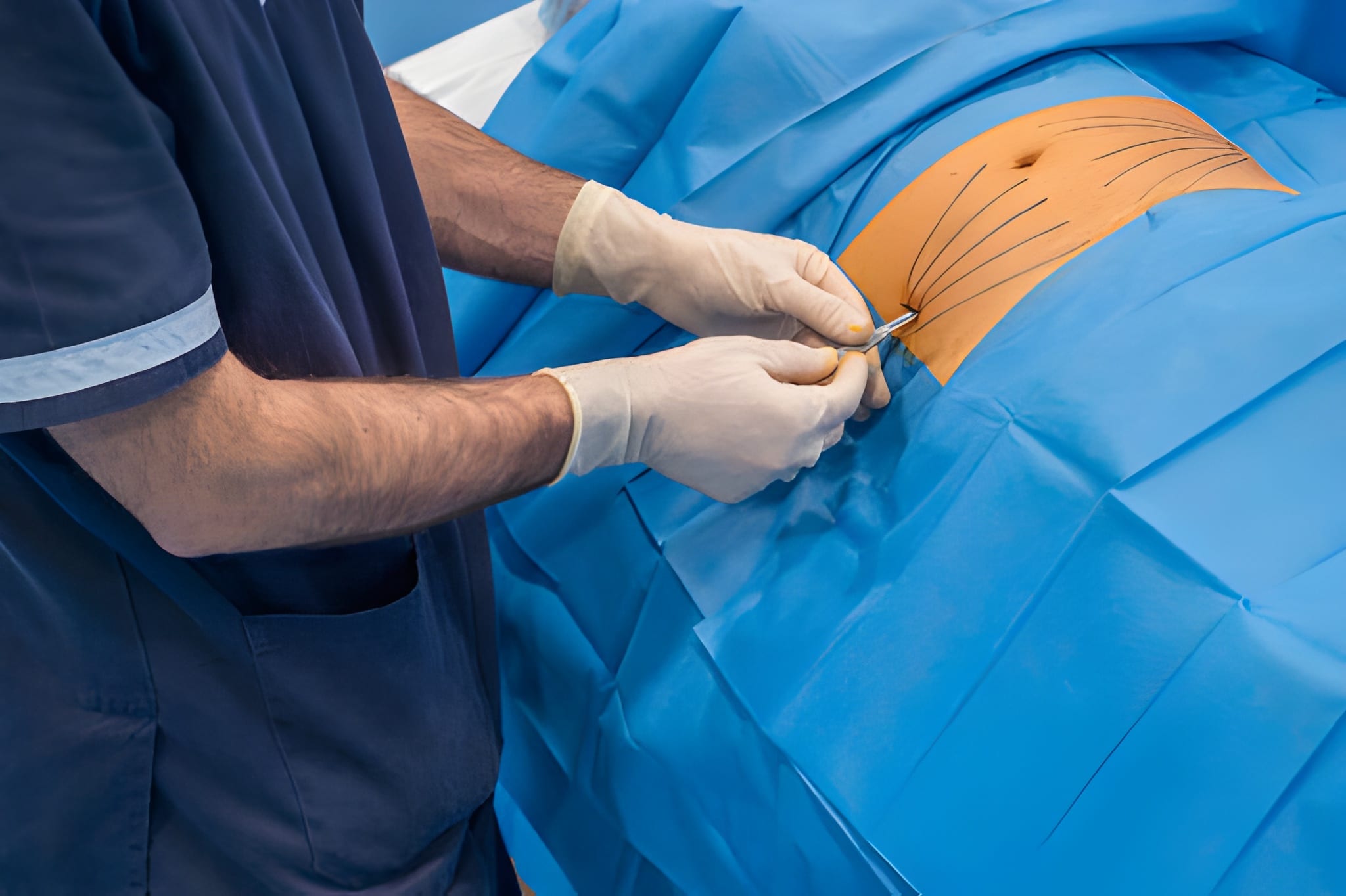 Knee replacement treatment
