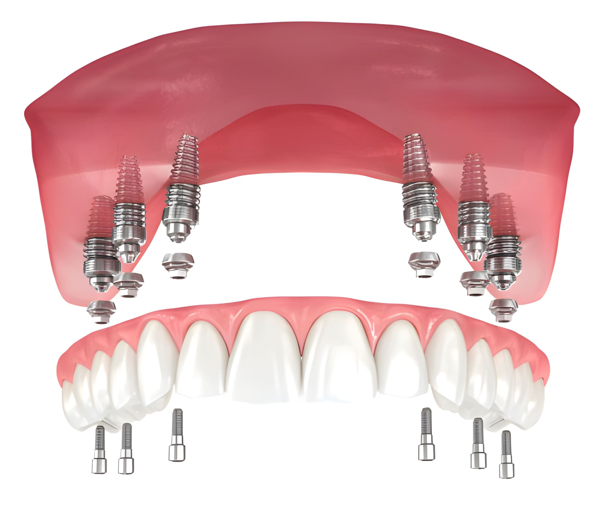 Spine surgery treatment