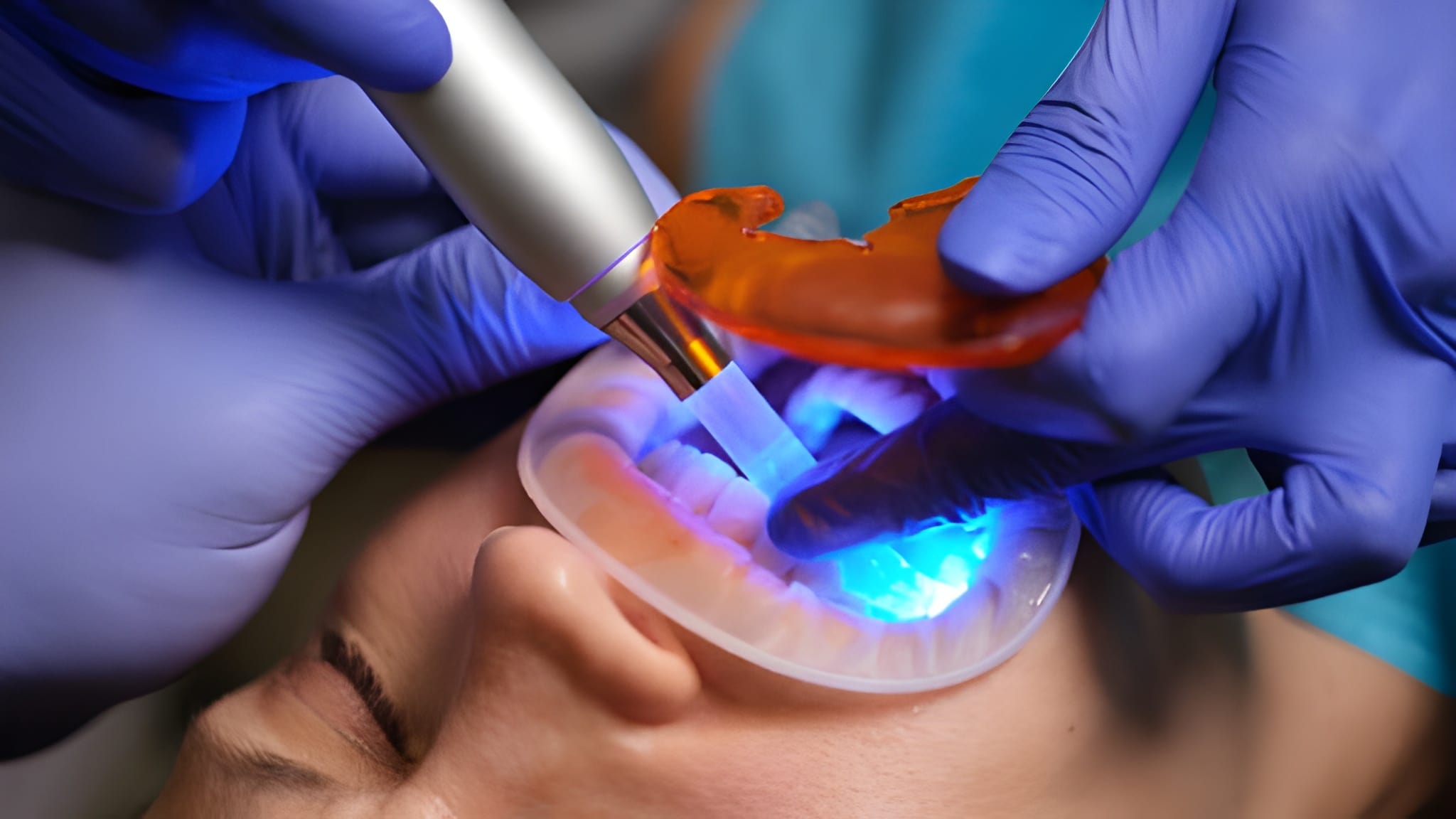 Sports injury treatment